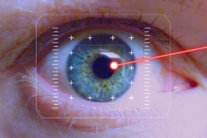 Know this before going laser eye surgery